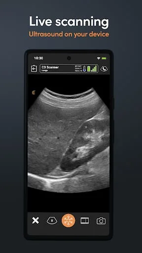 Clarius Ultrasound Screenshot 2