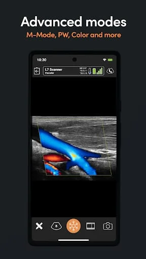 Clarius Ultrasound Screenshot 4